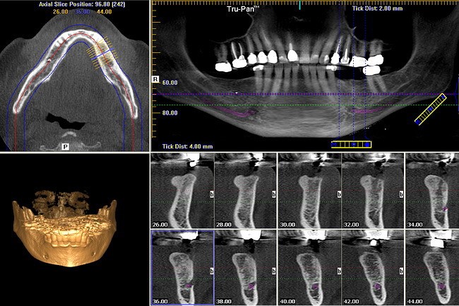 Cone Beam Ct Reconstruction Software Engineering